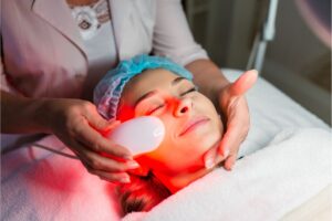 BBL Laser Skin Treatment