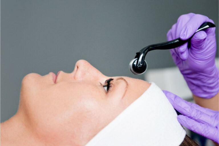 Microneedling Collagen Induction Therapy