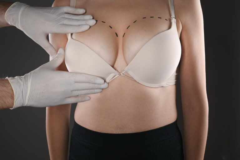 Breast Augmentation Basics