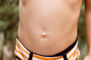 Outie Belly Button