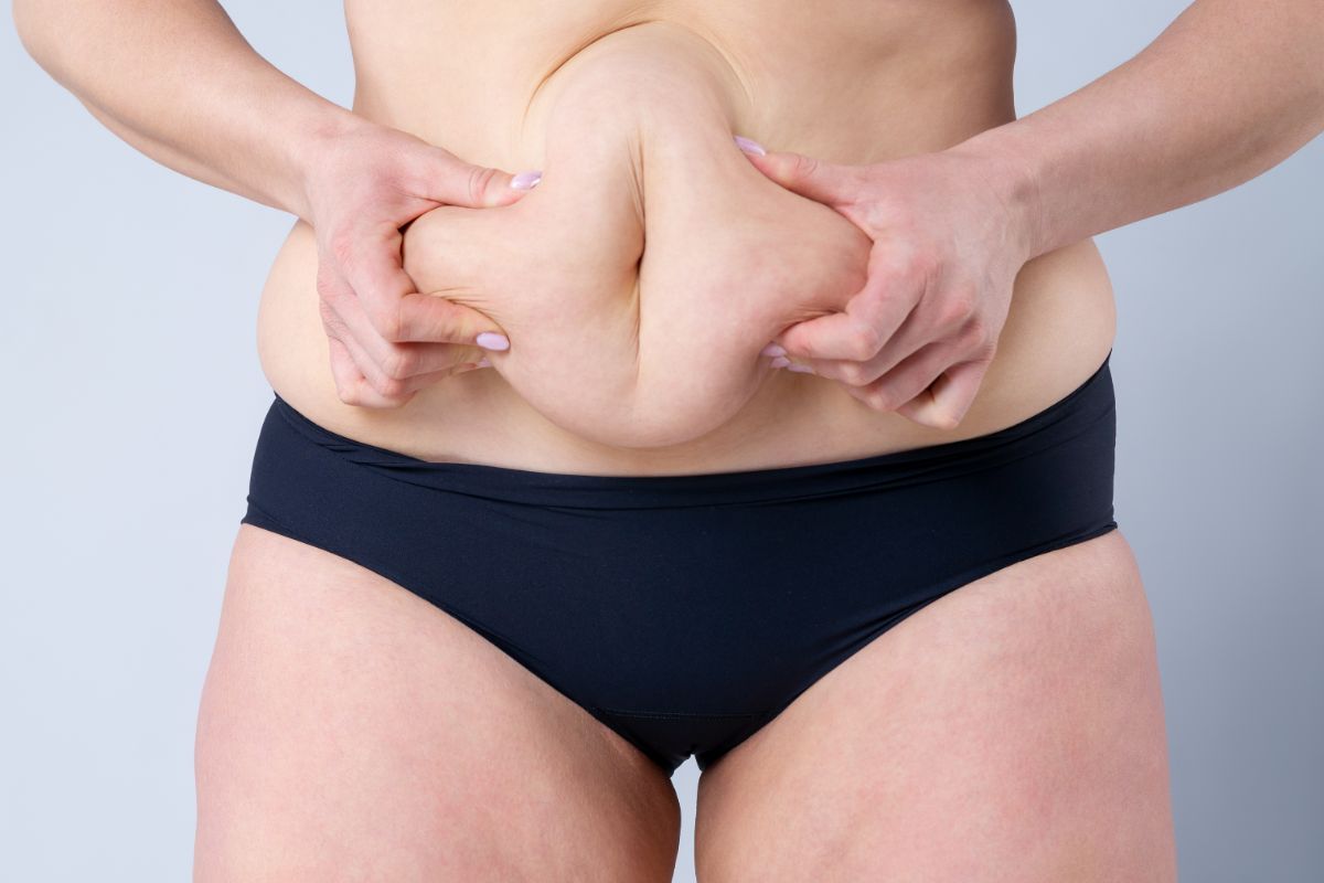 benefits of Tummy Tuck