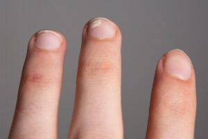 White Nail Spots