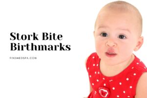 Stork Bite Birthmarks